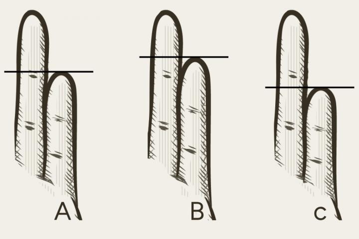 Acertijo visual de los dedos meñiques