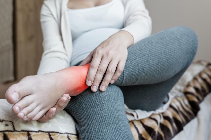 Una mujer con los tobillos hinchados.
