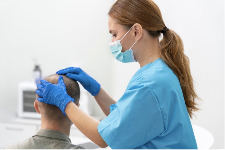 La realidad de la alopecia en España.