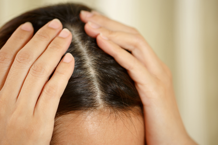 Consejos y productos para evitar la caída del pelo