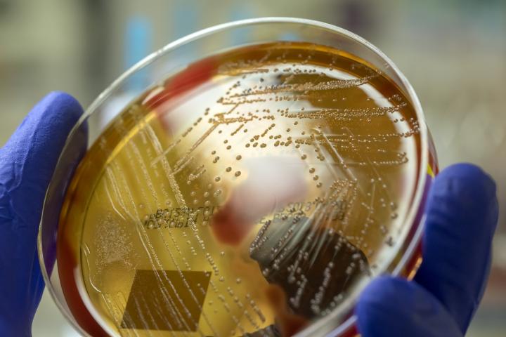 Imagen de archivo de un cultivo de Streptococcus pyogenes.
