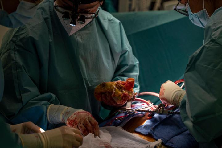 Imagen de un trasplante de corazón en el Hospital Puerta de Hierro