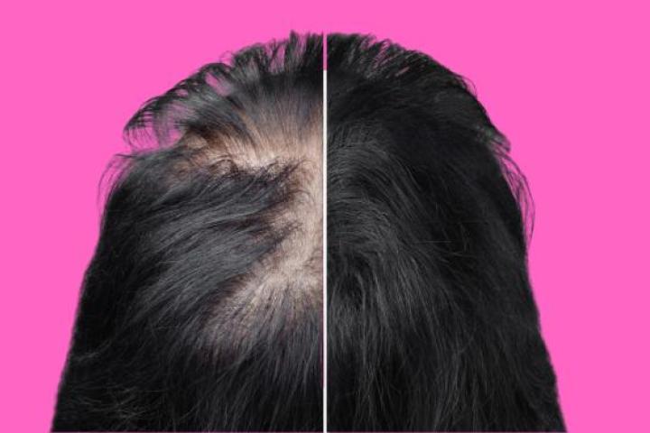 Polvo para rellenar el cabello más vendido de Amazon