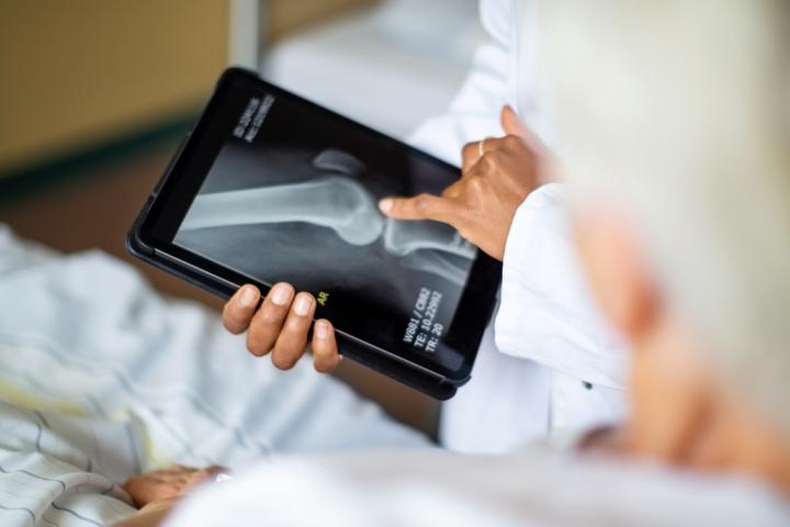Médico con una radiografía de un hueso