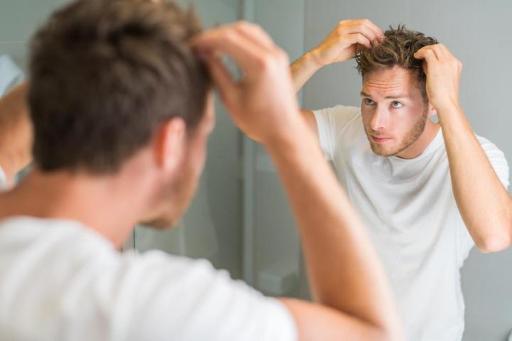 Estos son algunos productos que ayudan a combatir la caída del pelo en hombres