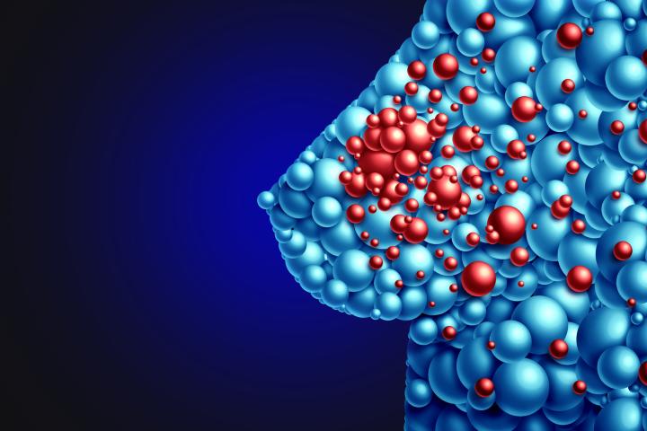 Ilustración cáncer de mama.