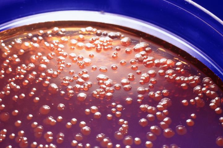 Imagen de archivo de un cultivo de laboratorio con salmonella.