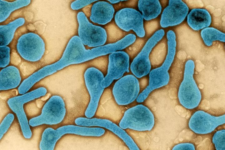 Partículas del virus de Marburgo.