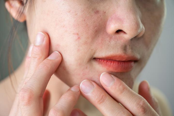 Rostro de una mujer.