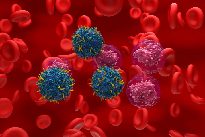 Ilustración de células T con receptor de antígeno quimérico (CAR) (azul) que atacan células de leucemia linfoblástica aguda (LLA) (violeta).