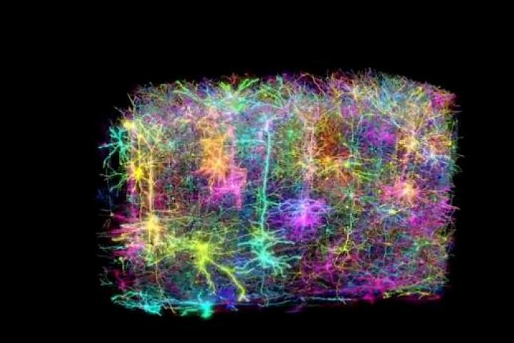 Imagen del mapeo cerebral.