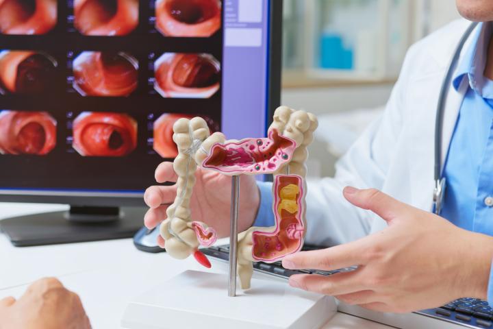 Imagen de archivo de una consulta en la que se explica el cáncer colorrectal.