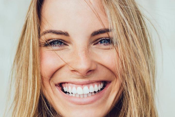 Una chica con una sonrisa blanca y perfecta