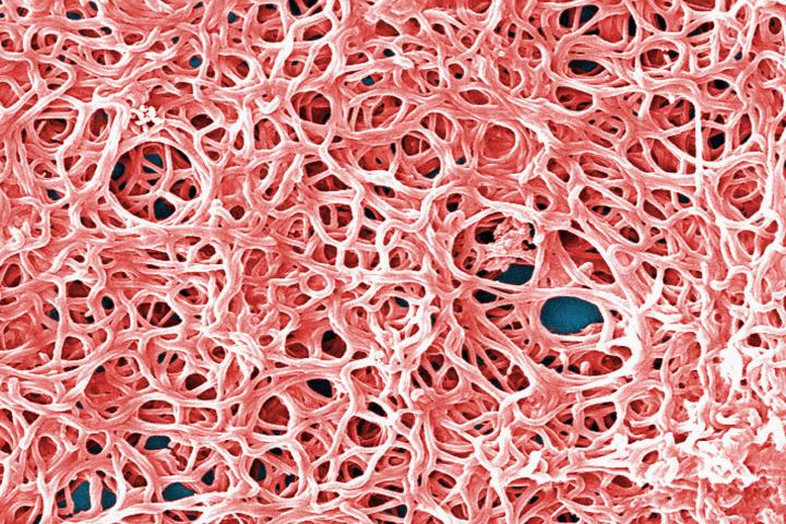 Vista microscópica de la bacteria que causa la enfermedad de Lyme y que transmiten insectos como las garrapatas.