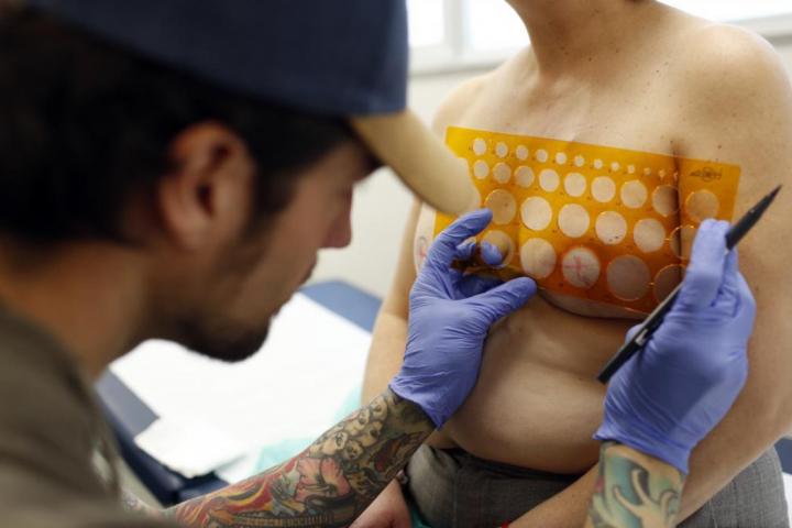 El tatuador Álvaro Quesada coloca una plantilla a una paciente antes de dibujar la areola-pezón