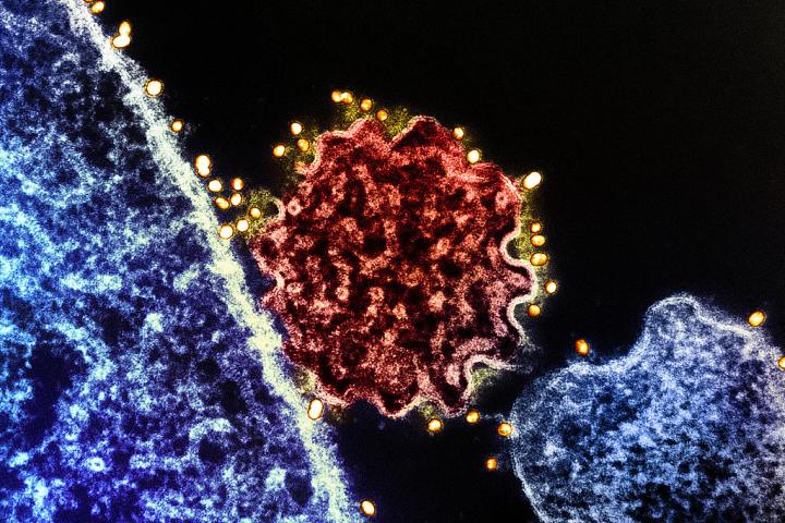 Imagen de un virus Nipah.