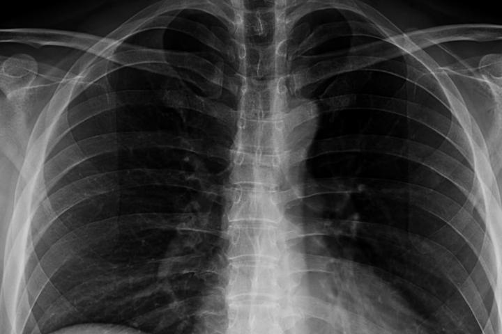 Una radiografía, en una imagen de archivo