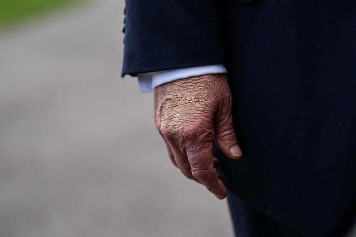 Plano corto de la mano derecha de Donald Trump en un acto por el 11-S en 2025