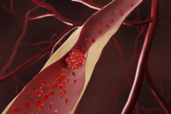 Colesterol en sangre.