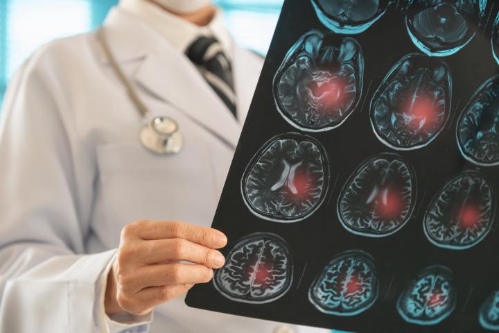 doctor-bueno-sintomas-ictus