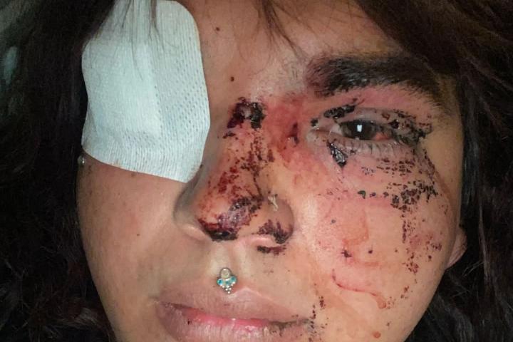 Una mujer transexual ha sufrido en La Bañeza (León) una paliza que le ha propinado supuestamente un grupo de entre ocho y diez personas, a la vez que recibía insultos homófobos y tránsfobos.