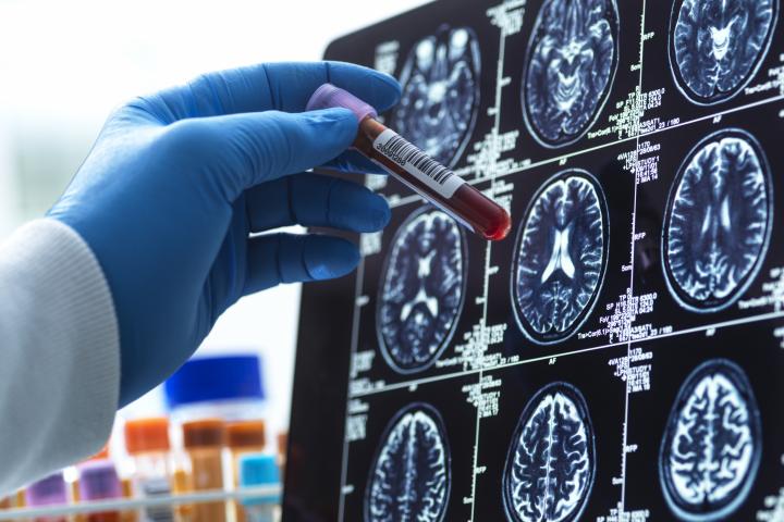 Un investigador con una muestra de sangre.