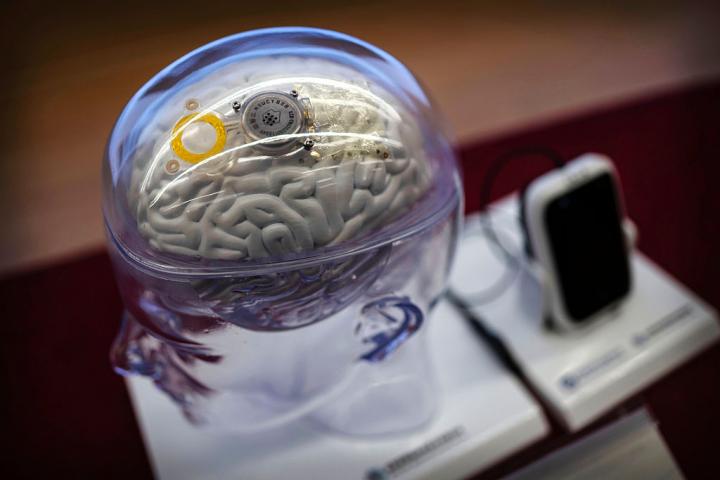 El implante cerebral Beinao-1