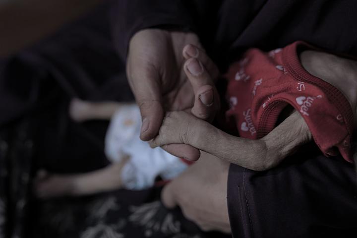 Remzi Bahara, un bebé de cinco meses de Yarmouk (Gaza), sufre de desnutrición severa debido a la falta de acceso a alimentos, en una imagen del 16 de febrero de 2026.