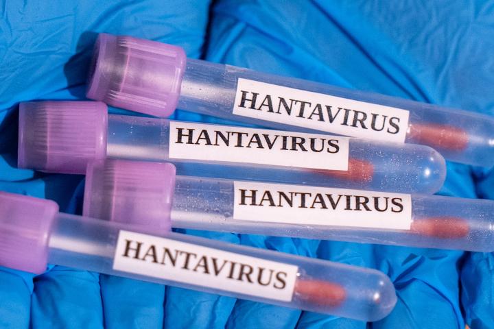 Ilustración de unas muestras de hantavirus