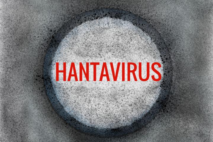 Hantavirus