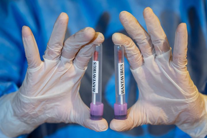 Tubos de muestras de hantavirus.