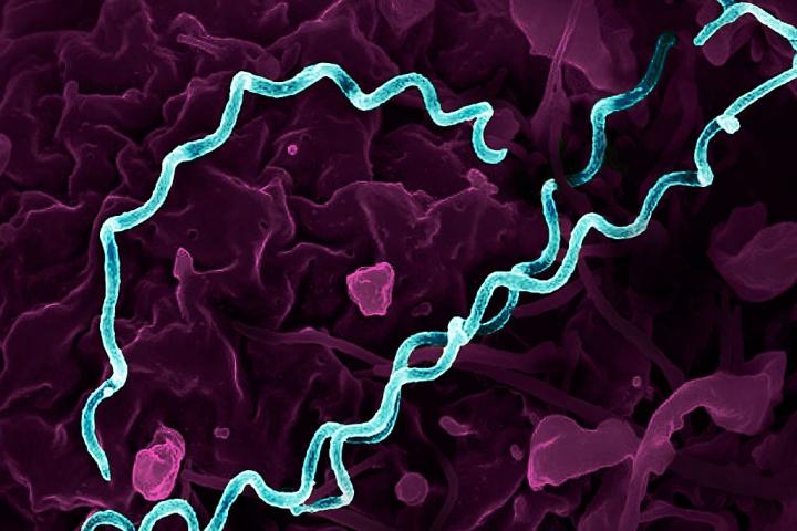 Imagen microscópica coloreada de la bacteria que causa la sífilis: "Treponema pallidum".