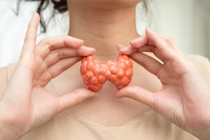 Hipertiroidismo, tiroides hiperactiva, linfoma tiroideo, modelo anatómico humano de mujer asiática con glándula tiroides.