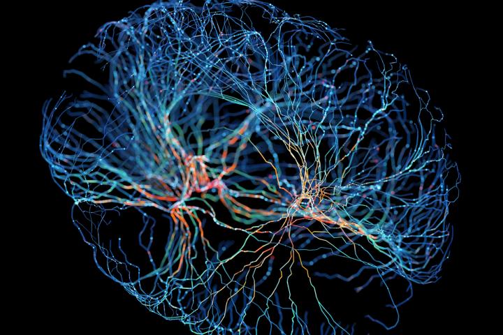 Un sistema de neuronas