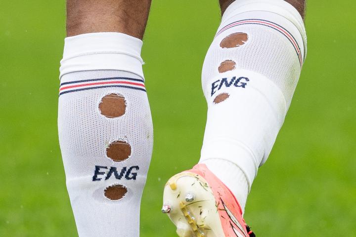 Las medias agujereadas de Jude Bellingham durante uno de los partidos del Mundial 2026