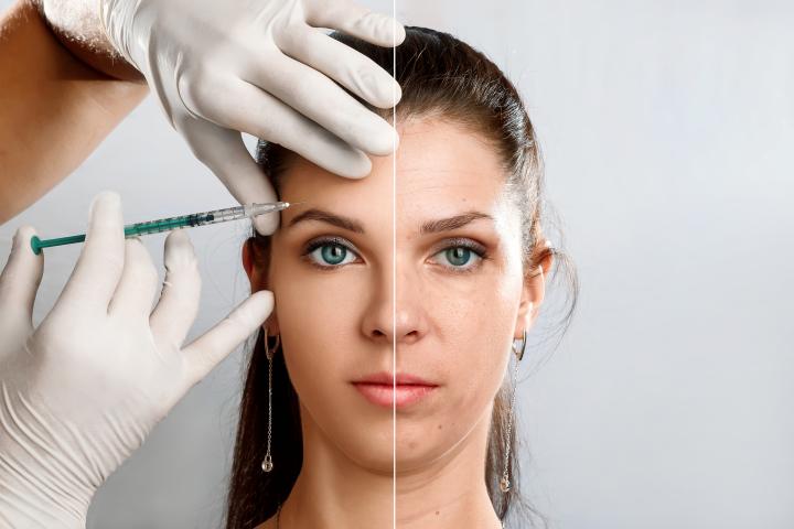 Una mujer jovenmostrando el efecto de las inyecciones de bótox.