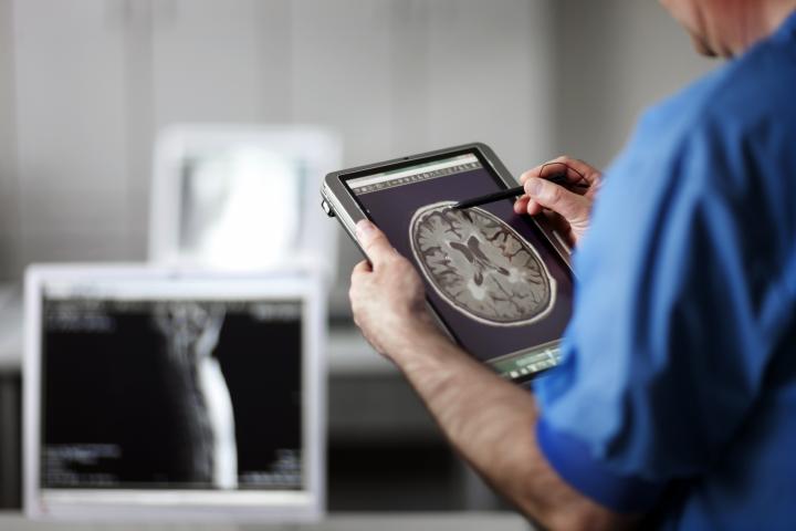 Médico analizando radiografía cerebral.