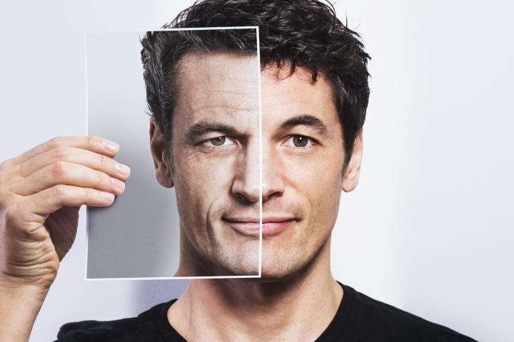 El antes y después de un hombre que ha recurrido a la medicina estética