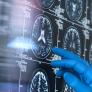 José López Barneo, catedrático de Fisiología y pionero en la investigación de las células madre: "Si todos viviéramos 120 o 130 años, acabaríamos con alzhéimer y Parkinson. El cerebro no puede regenerarse"