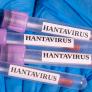 Así se ha disparado el interés por el hantavirus en todo el mundo, según las búsquedas en Google