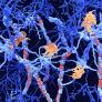 Una investigadora española firma en Nature un avance contra el Alzheimer, el Parkinson y la esclerosis múltiple: la inflamación cerebral es también el primer paso de la reparación