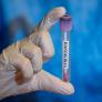 Sanidad confirma el primer positivo de hantavirus en España
