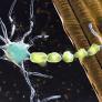 Un paciente paralizado por ELA vuelve a hablar con su familia gracias a un implante cerebral