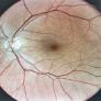 Durante más de cien años se pensó que no existía; ahora se ha encontrado un "sistema de eliminación de residuos" en la parte posterior del ojo