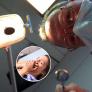 Va al dentista por un simple empaste, acaba perdiendo cuatro dientes y la Justicia condena al profesional: 45.000 euros por negligencia
