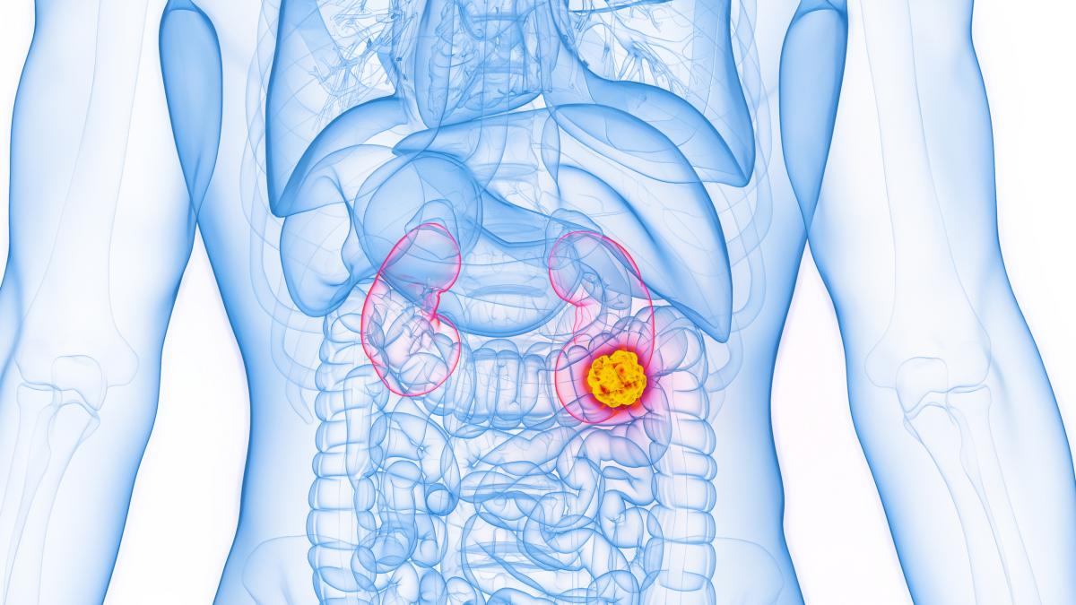 Una nueva vacuna contra el cáncer aviva las esperanzas tras lo ocurrido ...