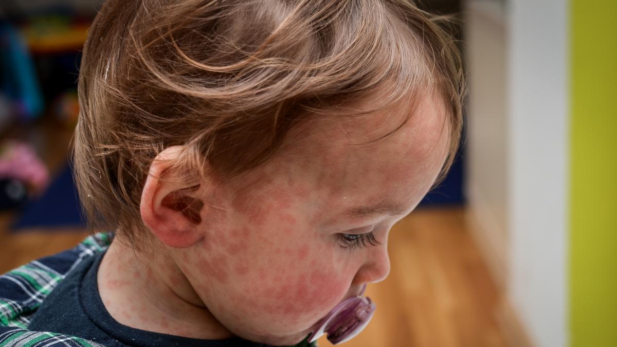 Un pasajero de un importante aeropuerto crea alarma al tener &quot;una enfermedad de las más infecciosas&quot;