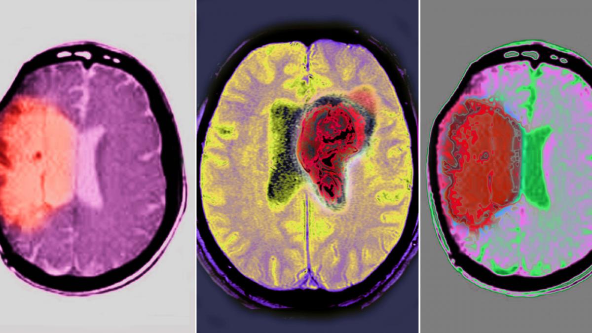 Tras 29 horas de espera en urgencias, esta mujer de 80 años descoloca a todos con su reseña