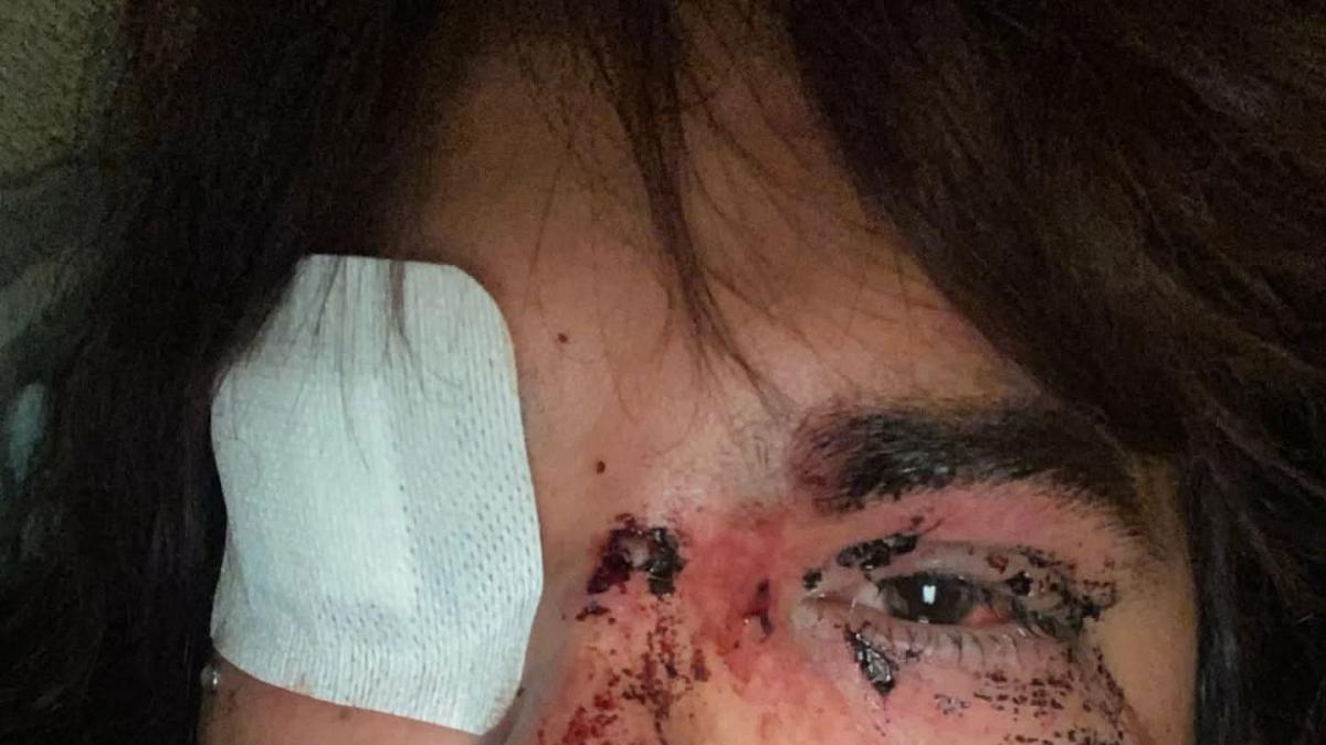 Cinco detenidas por la agresión a la mujer trans en un pub de La Bañeza (León)