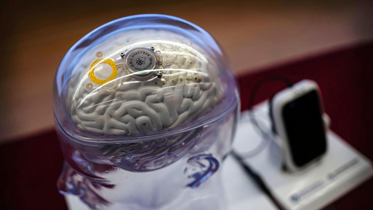 Ni Neuralink ni Silicon Valley: China acaba de aprobar el primer implante cerebral comercial del mundo